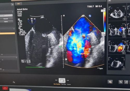 Cảnh báo: Hiểm hoạ tim mạch khôn lường vì tiêm thuốc giảm đau vào khớp tại phòng khám tư nhân