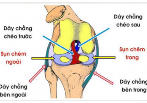 Thoái hoá khớp - vì sao dễ bị