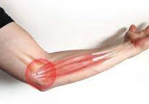 BIỆN PHÁP PHÒNG TRÁNH ĐAU KHỚP KHUỶU TAY