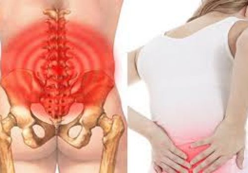TRIỆU CHỨNG VÀ NGUYÊN NHÂN CỦA BỆNH ĐAU LƯNG DƯỚI