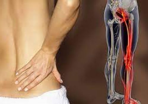 Nên ăn gì và kiêng gì khi bị đau thần kinh tọa?