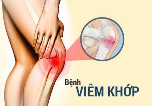 Viêm khớp: Nguyên nhân, triệu chứng, chẩn đoán và điều trị