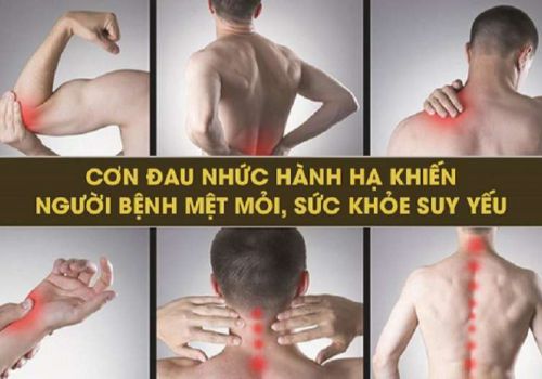 Bệnh THOÁI HÓA KHỚP Là Gì? Nguyên Nhân, Triệu Chứng Và Cách Phòng Ngừa Hiệu Quả