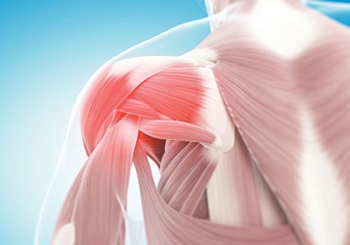 ĐAU NHỨC ÂM Ỉ VAI VÀ CÁNH TAY - COI CHỪNG HỘI CHỨNG CHÓP XOAY VAI